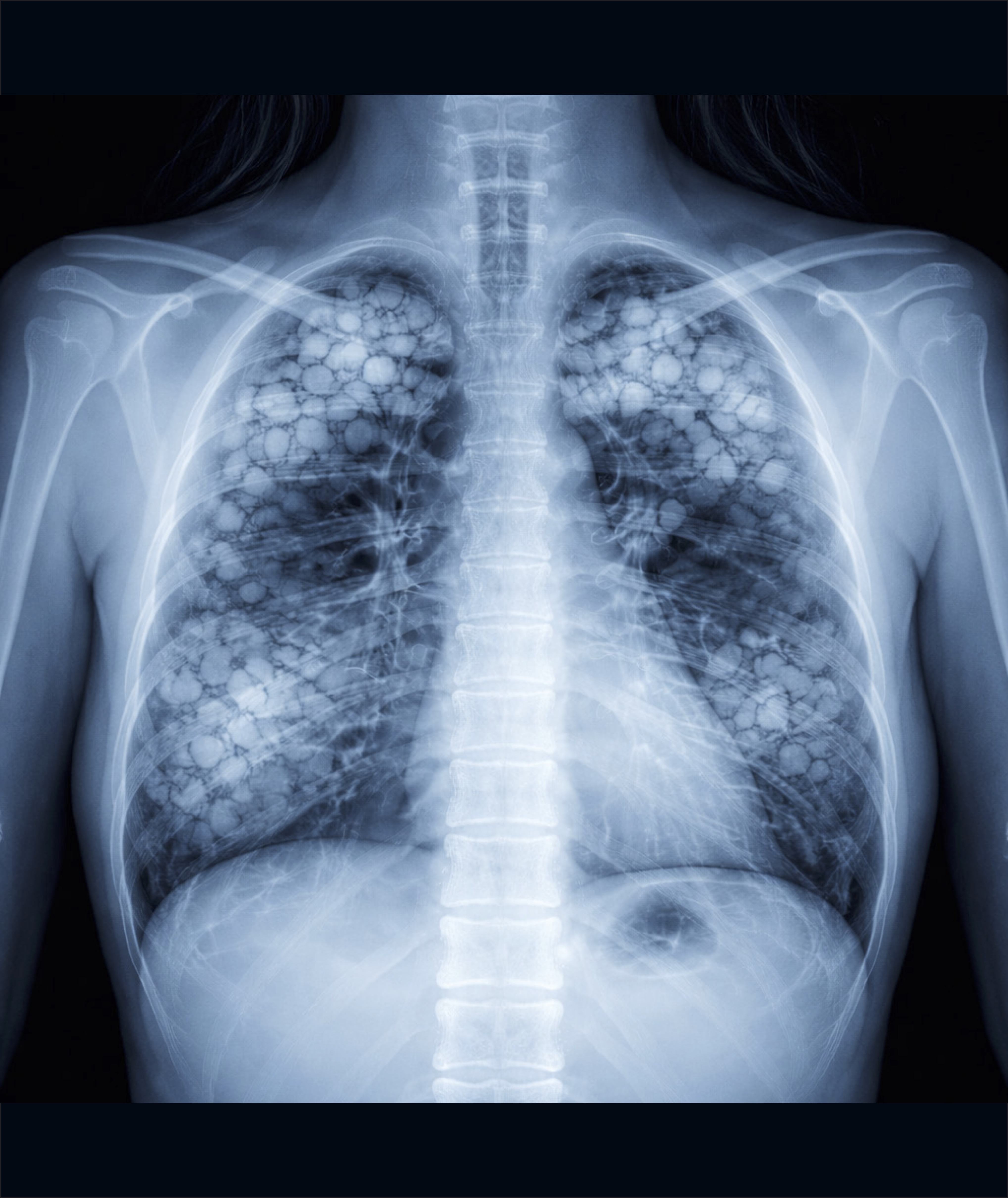 Raio X — Imagem 01