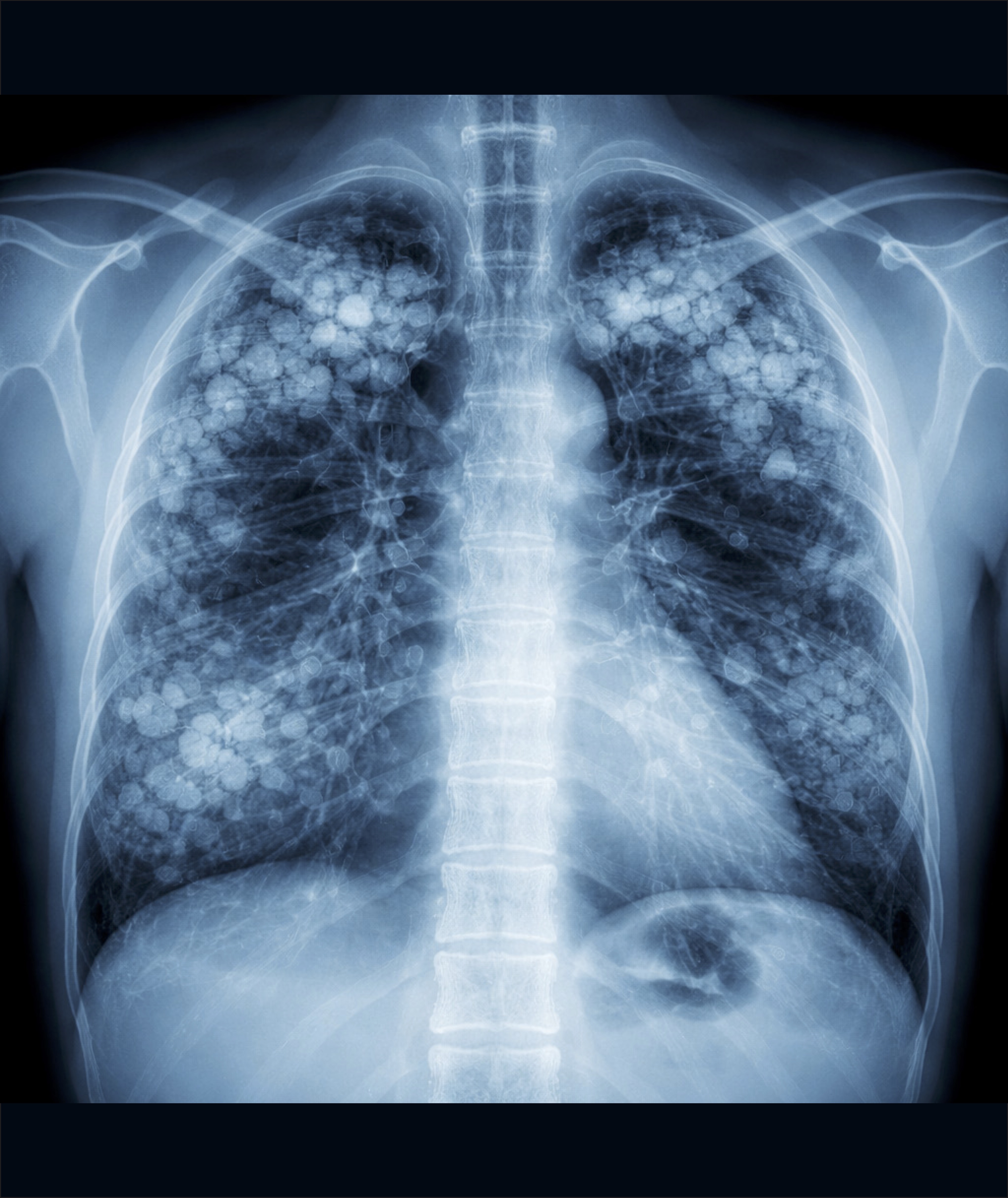 Raio X — Imagem 02