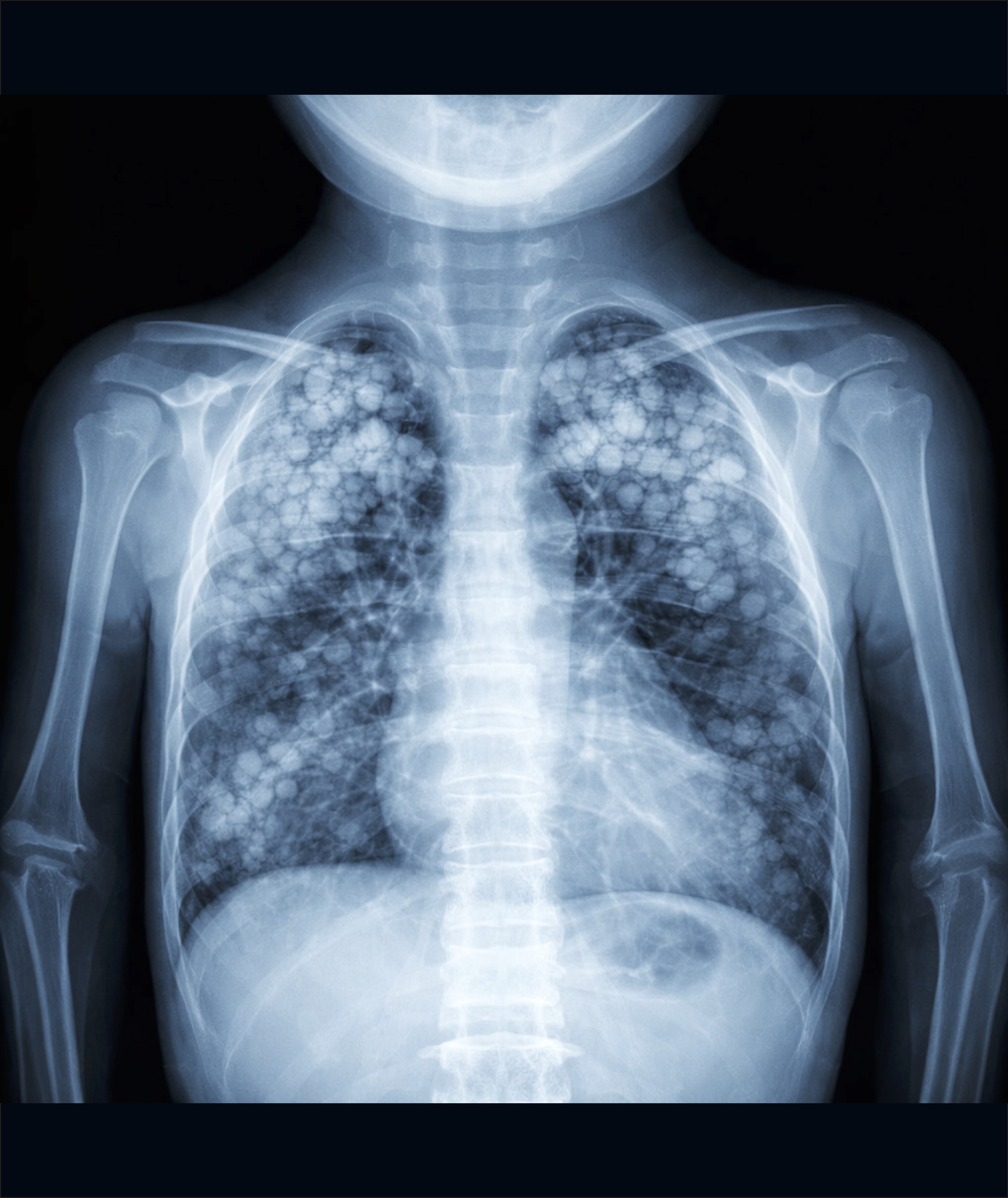 Raio X — Imagem 03